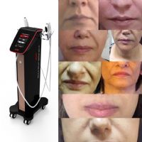 خریدوفروش واجاره هایفواولتراسونیک
