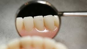 لابراتوارپروتزهای دندانی